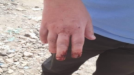 "ميون" تدين الاعتداء على الدكتور الكبسي من قبل جماعة مسلحة في العاصمة صنعاء