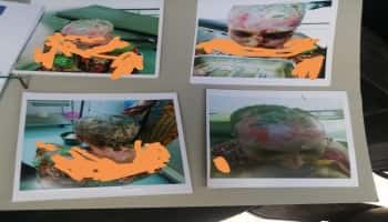 رفضت مجامعته فنكّل بها.. "فتاة عدن" تكشف تفاصيل إحراقها بالأسيد على يد زوجها