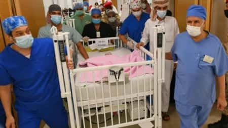 الرياض: العاهل السعودي يوجه بنقل التوأم السيامي اليمني "مودة ورحمة" إلى الرياض