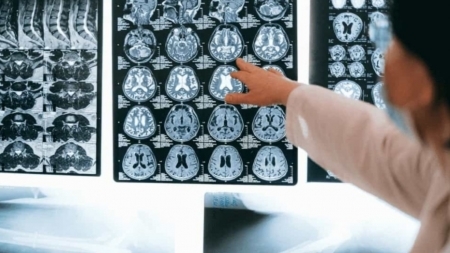 كيف يمكن لضربة واحدة على الرأس أن تحولك إلى مجرم مدى الحياة؟